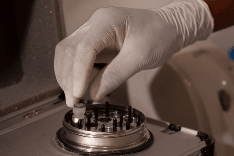 Aspiração folicular