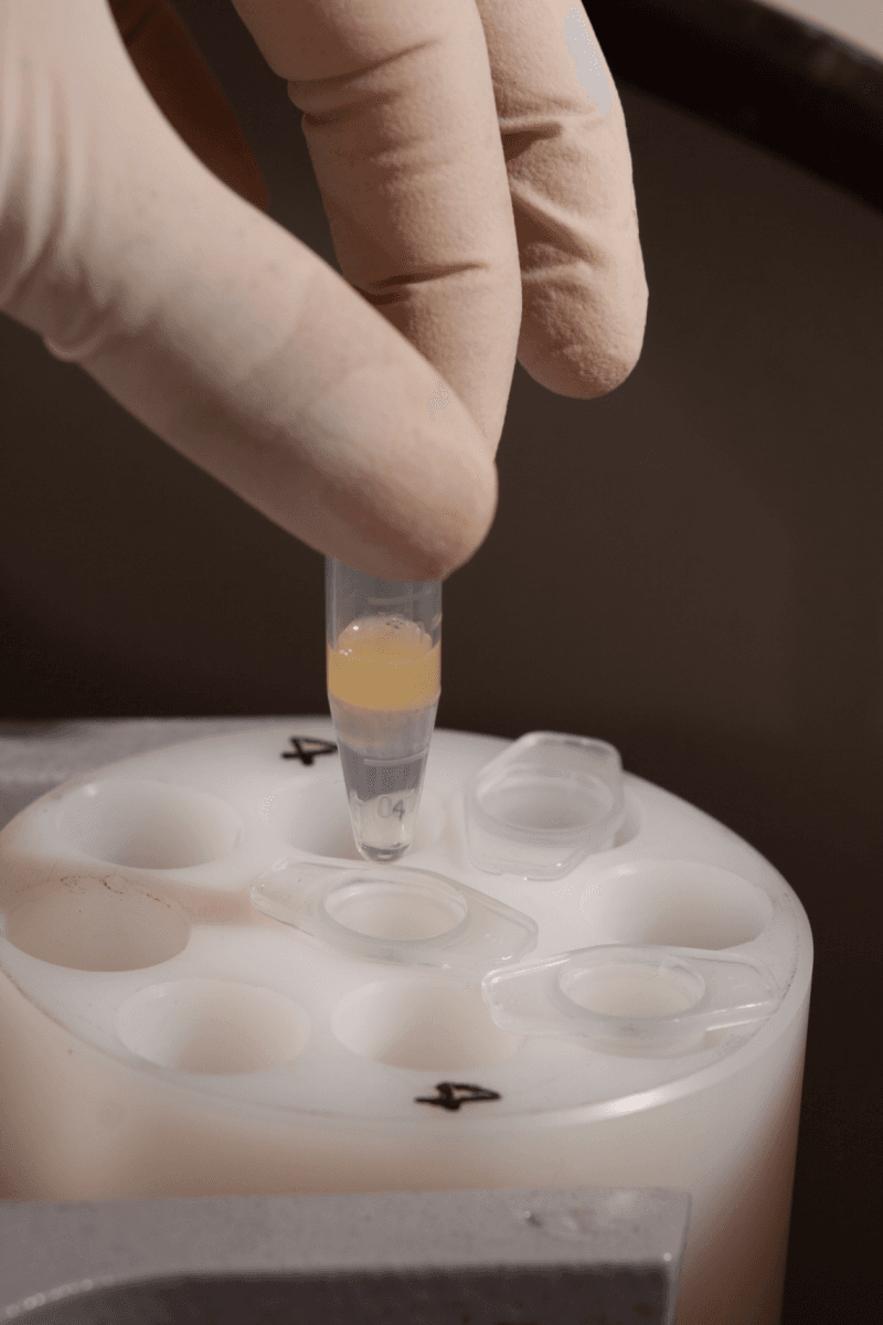 Separação de material genético